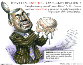 BEN CARSON AND HIS BRAIN  by Taylor Jones