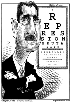 ASSAD EYE EXAM by Taylor Jones